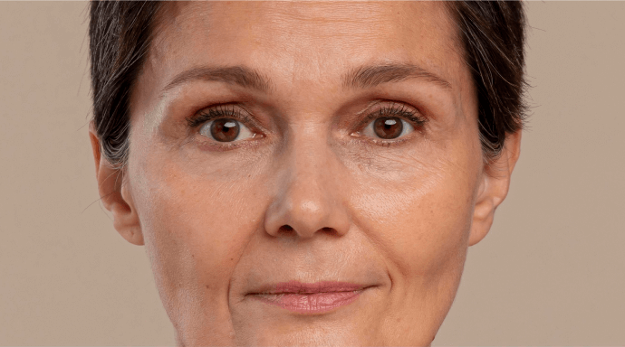 Güzellik uygulaması sonrası