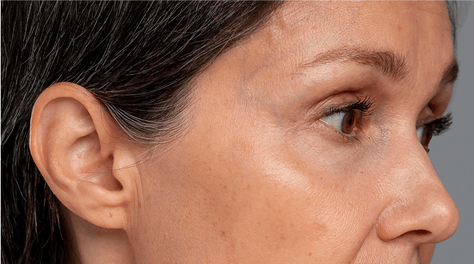 Cilt bakımı öncesi