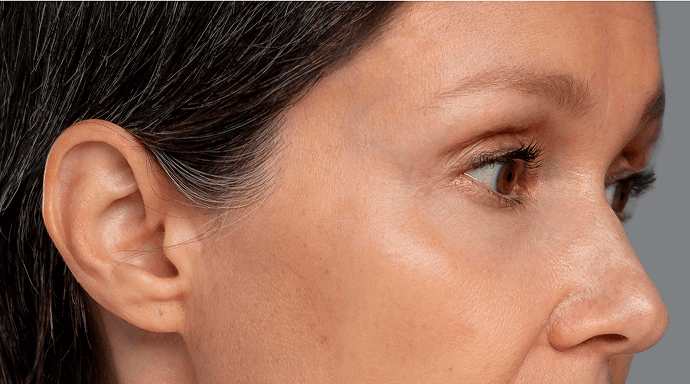 Cilt bakımı sonrası